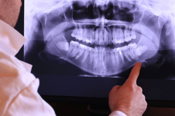 Best After-Hours Dental Trauma Care in Many, LA