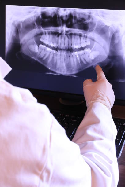Best Emergency Tooth Extraction in Many, LA
