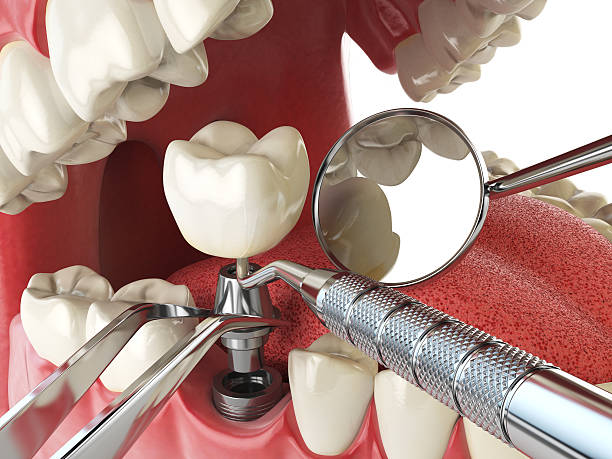 Best Emergency TMJ Treatment in Many, LA
